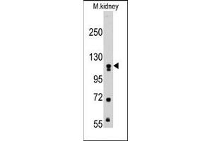 Image no. 1 for anti-Muscle, Skeletal, Receptor Tyrosine Kinase (MUSK) antibody (ABIN359904) (MUSK anticorps)