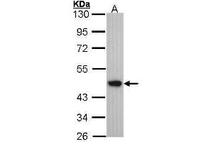 WB Image Sample (30 ug of whole cell lysate) A: A431 , 10% SDS PAGE antibody diluted at 1:1000 (Medium-Chain Specific Acyl-CoA Dehydrogenase, Mitochondrial (N-Term) anticorps)