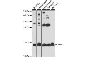 Western blot analysis of extracts of various cell lines, using  antibody (ABIN7265482) at 1:1000 dilution. (ARF4 anticorps  (AA 1-180))