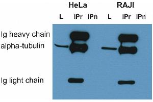 Immunoprecipitation of alpha-tubulin from HeLa and RAJI cell lysate by antibody TU-16 and its detection by antibody TU-01.