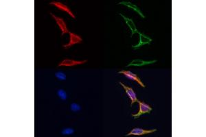ABIN6262232 and ABIN6266695 staining Hela by IF/ICC.