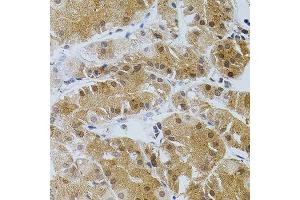 Immunohistochemistry of paraffin-embedded human stomach using TGM2 antibody. (Transglutaminase 2 anticorps)
