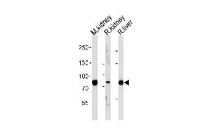 Western blot analysis of lysates from mousr kidney, rat kidney and liver tissue (from left to right), using EHHADH Antibody at 1:1000 at each lane. (EHHADH anticorps  (C-Term))