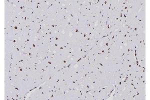 ABIN6276683 at 1/100 staining Human heart tissue by IHC-P. (APOBEC3G anticorps  (C-Term))