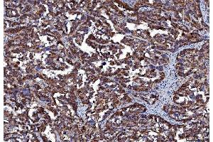 IHC analysis of CD147/Emmprin using anti-CD147/Emmprin antibody (ABIN7599998).