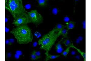 Image no. 2 for anti-Cardiac Troponin I (TNNI3) antibody (ABIN1497101)
