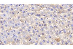 Detection of ALB in Rat Liver Tissue using Polyclonal Antibody to Albumin (ALB)