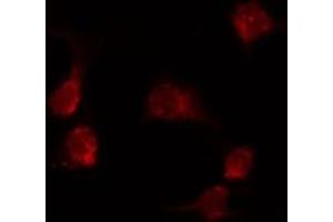 ABIN6274020 staining MCF7 by IF/ICC. (KDELR1 anticorps  (Internal Region))