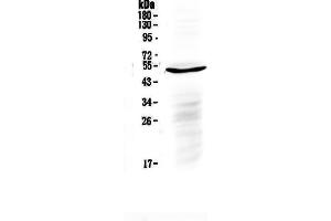 Western blot analysis of IL6R using anti-IL6R antibody . (IL-6 Receptor anticorps  (C-Term))