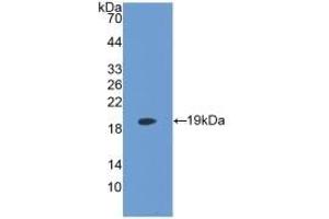 Detection of Recombinant LPCAT3, Human using Monoclonal Antibody to Lysophosphatidylcholine Acyltransferase 3 (LPCAT3)