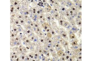 Immunohistochemistry of paraffin-embedded Rat liver using HIRIP3 Polyclonal Antibody at dilution of 1:100 (40x lens).
