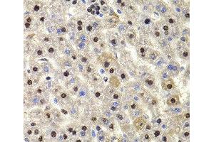Immunohistochemistry of paraffin-embedded Rat liver using HIRIP3 Polyclonal Antibody at dilution of 1:100 (40x lens). (HIRIP3 anticorps)