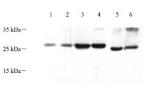 Western blot analysis of HOXD12 (ABIN7074252) at dilution of 1: 500 (HOXD12 anticorps)