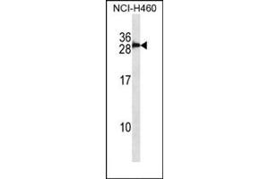 Western blot analysis in NCI-H460 cell line lysates (35 ug/lane) using S100B Antibody (Center) Cat. (S100B anticorps  (Middle Region))