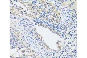 Immunohistochemistry of paraffin-embedded Rat ovary using C12orf10 Polyclonal Antibody at dilution of 1:100 (40x lens). (C12orf10 anticorps)