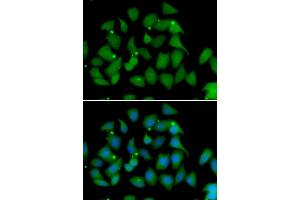 Immunofluorescence analysis of HeLa cell using FMO1 antibody.