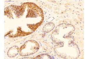 Immunohistochemistry (IHC) image for anti-Growth Arrest and DNA-Damage-Inducible, beta (GADD45B) (Middle Region) antibody (ABIN2783334)