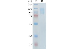 Human R1(21-521 1097-1246) Protein, His Tag on SDS-PAGE under reducing condition.