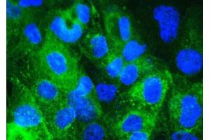 IF analysis of Beta 2 Microglobulin using anti- Beta 2 Microglobulin antibody (ABIN5518810).