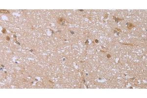 Immunohistochemistry of paraffin-embedded Human brain using FHL2 Polyclonal Antibody at dilution of 1:40 (FHL2 anticorps)