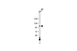 Anti-C12orf30 Antibody (Center) at 1:1000 dilution + HL-60 whole cell lysate Lysates/proteins at 20 μg per lane. (NAA25 anticorps  (AA 720-748))