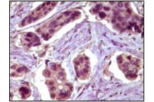Immunohistochemistry (IHC) image for anti-B-Cell CLL/lymphoma 10 (BCL10) antibody (ABIN2464015) (BCL10 anticorps)