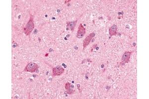 Immunohistochemical staining of human brain, neurons and glia (BAI2 anticorps  (N-Term))