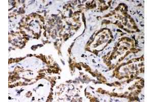 Immunohistochemistry (Paraffin-embedded Sections) (IHC (p)) image for anti-ATP-Binding Cassette, Sub-Family G (WHITE), Member 2 (ABCG2) (AA 137-168), (N-Term) antibody (ABIN3043775)