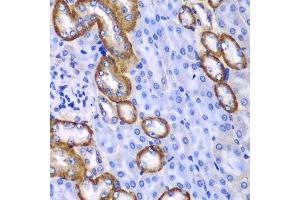 Immunohistochemistry of paraffin-embedded mouse kidney using MYO1C antibody.