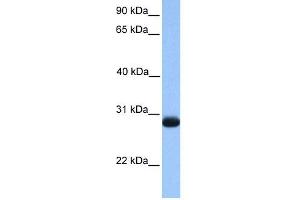 WB Suggested Anti-ZMAT3 Antibody Titration:  0.