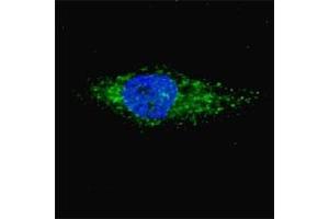 Fluorescent image of Chloroquine treated U251 cells (50 uM, 16h) stained with LC3A antibody. (MAP1LC3A anticorps  (AA 30-56))