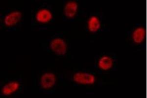 ABIN6275744 staining HepG2 by IF/ICC. (NPAS1 anticorps  (Internal Region))