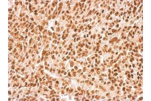 IHC-P Image APE1 antibody [N1], N-term detects APEX1 protein at nucleus on Saos2 xenograft by immunohistochemical analysis. (APEX1 anticorps  (N-Term))