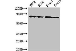 Western Blot Positive WB detected in: K562 whole cell lysate, HL60 whole cell lysate, Mouse heart tissue, Mouse brain tissue All lanes: BTK antibody at 3. (BTK anticorps  (AA 254-443))