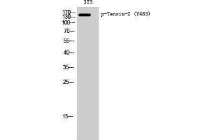 Western Blotting (WB) image for anti-Tensin Like C1 Domain Containing Phosphatase (Tensin 2) (TENC1) (pTyr483) antibody (ABIN3172982) (TENC1 anticorps  (pTyr483))