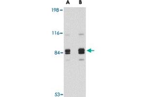 Western blot analysis of SNPH in rat brain tissue lysate with SNPH polyclonal antibody  at (A) 1 and (B) 2 ug/mL .