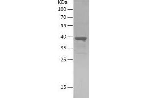 Western Blotting (WB) image for Prothymosin, alpha (PTMA) (AA 1-111) protein (His-IF2DI Tag) (ABIN7124695)