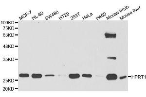 Western blot analysis of extracts of various cell lines, using HPRT1 antibody. (HPRT1 anticorps  (AA 1-218))