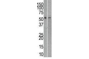 Image no. 1 for anti-RuvB-Like 2 (E. Coli) (RUVBL2) (C-Term) antibody (ABIN357238) (RUVBL2 anticorps  (C-Term))