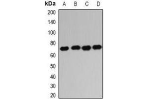 Western blot analysis of IGF2BP1 expression in HL60 (A), K562 (B), NIH3T3 (C), mouse liver (D) whole cell lysates. (IGF2BP1 anticorps)