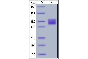 Human Mesothelin (296-580), His Tag, low endotoxin on  under reducing (R) condition.
