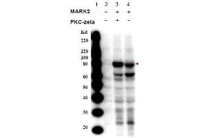 Image no. 1 for anti-MAP/microtubule Affinity-Regulating Kinase 2 (MARK2) (Isoform A), (pThr595) antibody (ABIN401318) (MARK2 anticorps  (Isoform A, pThr595))