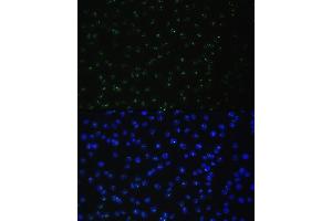Immunofluorescence analysis of C6 cells using DDX50 antibody (ABIN6129371, ABIN6139509, ABIN6139510 and ABIN6224730) at dilution of 1:100. (DDX50 anticorps  (AA 1-135))