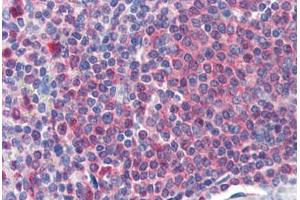 Human Spleen (formalin-fixed, paraffin-embedded) stained with CAT antibody ABIN364408 at 2 ug/ml followed by biotinylated anti-goat IgG secondary antibody ABIN481715, alkaline phosphatase-streptavidin and chromogen.