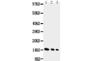 Anti-IL4 antibody, Western blotting Lane 1: Recombinant Mouse IL-4 Protein 10ng Lane 2: Recombinant Mouse IL-4 Protein 5ng Lane 3: Recombinant Mouse IL-4 Protein 2.