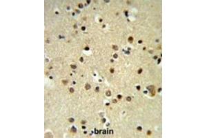 Immunohistochemistry (IHC) image for anti-Chromobox Homolog 1 (CBX1) antibody (ABIN3003963)