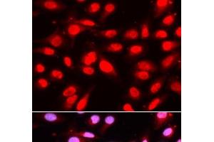 Immunofluorescence analysis of U2OS cells using U2AF2 Polyclonal Antibody (U2AF2 anticorps)