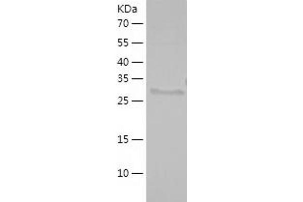ZBTB14/ZFP161 Protein (AA 151-427) (His tag)
