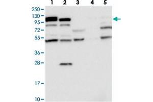 Western blot analysis of Lane 1: RT-4, Lane 2: U-251 MG, Lane 3: Human Plasma, Lane 4: Liver, Lane 5: Tonsil with OAS3 polyclonal antibody  at 1:250-1:500 dilution.