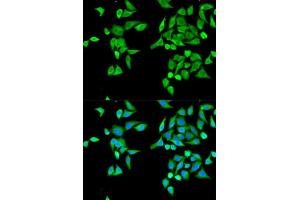 Immunofluorescence analysis of MCF-7 cell using CES2 antibody. (CES2 anticorps  (AA 310-410))